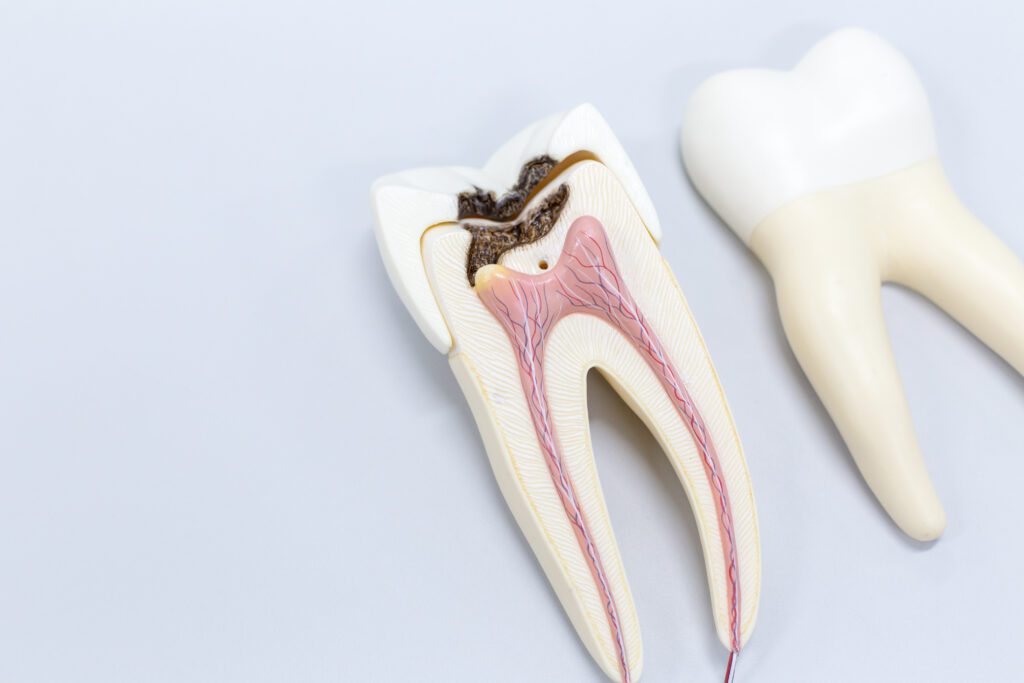 root canal in Sterling, dentist near me